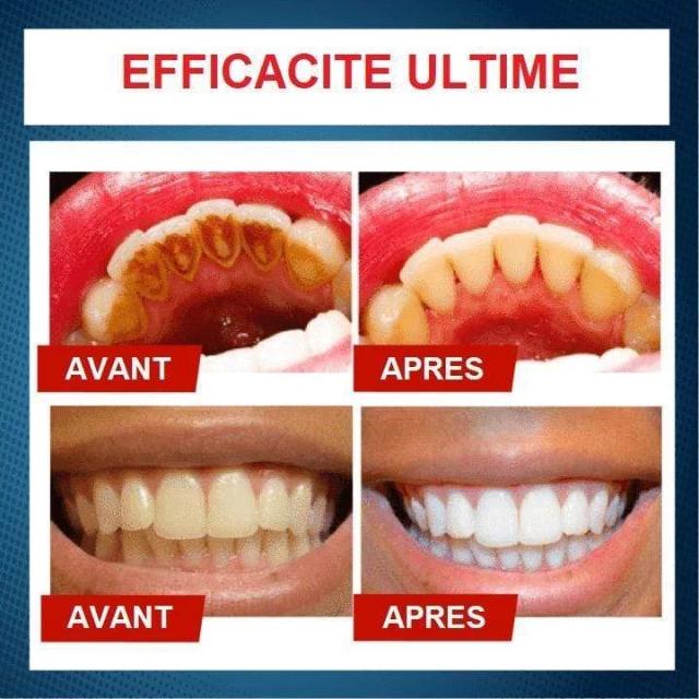 Gadgets d'Eve PEARLI™ : Dentifrice Blanchissant Anti-Taches Intensif