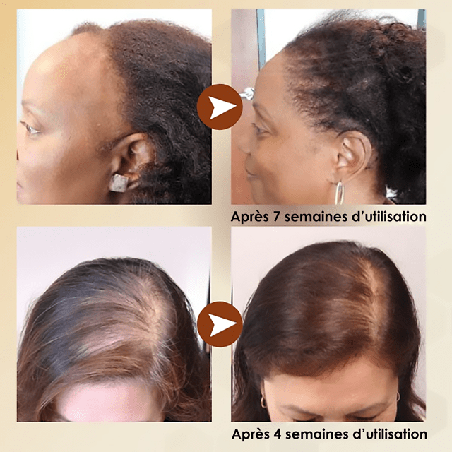 Gadgets d'Eve SPRAYIT™ : Spray Repousse Cheveux en Gingembre